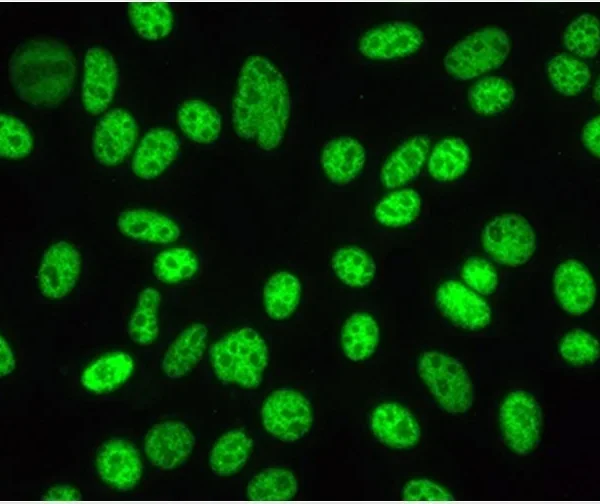 Anticorpos antinucleares